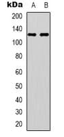 EPHA4 / EPH Receptor A4 Antibody (phospho-Tyr596)