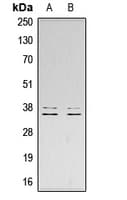 LAT Antibody (C-Terminus)