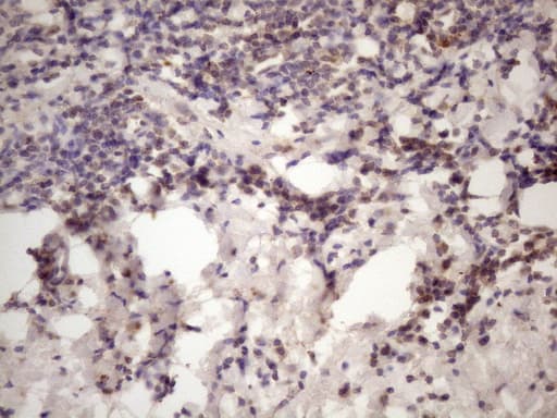 C1orf106 Antibody (aa1-270, clone OTI6A6, Carrier-free)