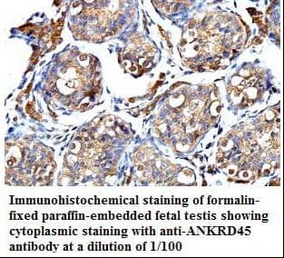 Polyclonal Rabbit anti-Human ANKRD45 Antibody (aa72-258, IHC, WB)