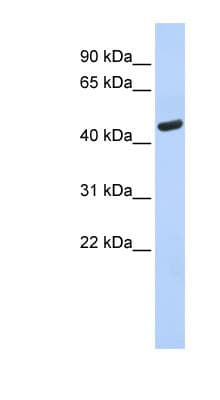 WARS Antibody (aa35-84)