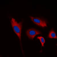 Polyclonal Rabbit anti-Human INPP5J / PIB5PA Antibody (C-Terminus, IHC, IF, WB)