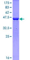 Human PPIA / Cyclophilin A Protein (Recombinant GST)