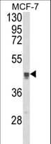 TGN46 / TGN38 Antibody (aa399-427)