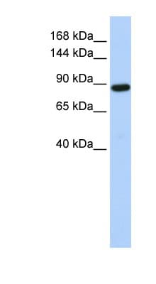 Polyclonal Rabbit anti-Human HACE1 Antibody (aa792-841, WB)