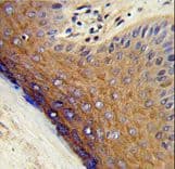 Polyclonal Rabbit anti-Human PSMD7 / MOV34 Antibody (aa6-34, IHC, WB)