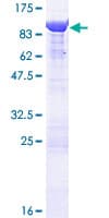 Human ANXA6/Annexin A6/Annexin VI Protein (Recombinant GST)