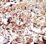 PCK2 / PEPCK Antibody (aa24-54)