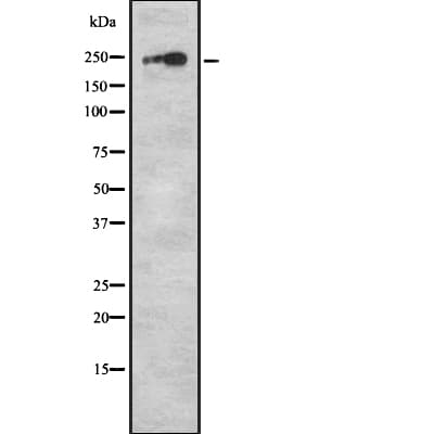 Polyclonal Rabbit anti-Human F5 / Factor Va Antibody (IHC, WB)