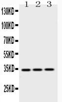 Polyclonal Rabbit anti-Human EMD / Emerin Antibody (IHC, WB)
