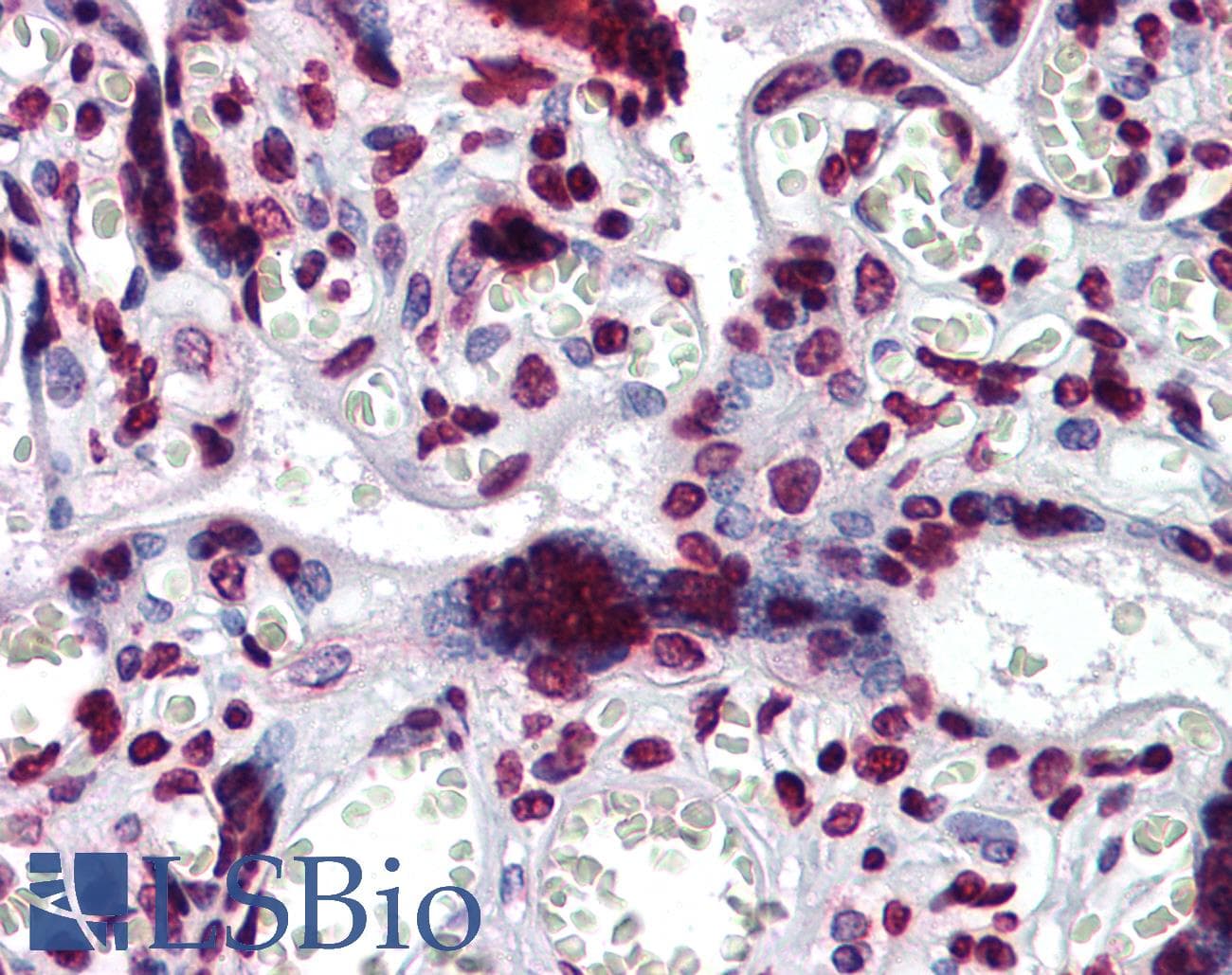 IHC-plus™ BAZ1B / WSTF Antibody (clone 5E9)