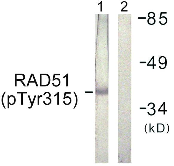 RAD51 / RECA Antibody (phospho-Tyr315)