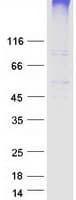 Human SLC19A3 Protein (Recombinant Myc-DDK (Flag))