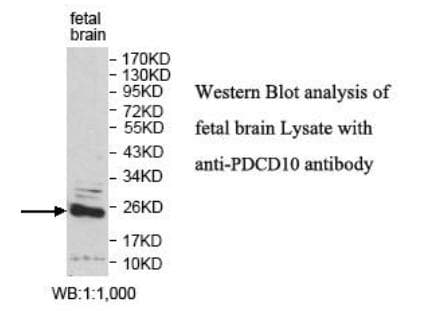 Polyclonal Rabbit anti-Human PDCD10 Antibody (aa2-212, WB)