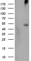 Monoclonal Mouse anti-Human SHPK / CARKL Antibody (clone OTI3D7, IHC, IF, WB)