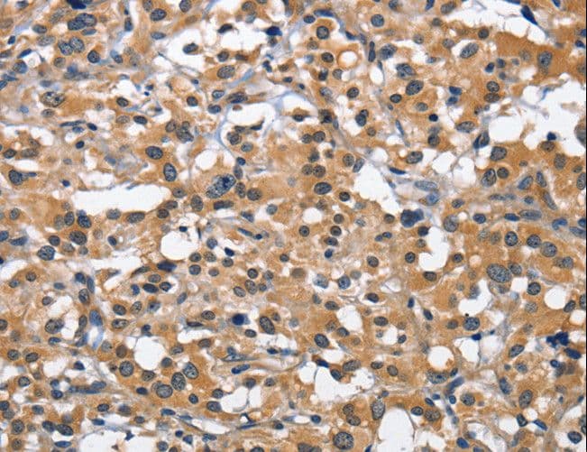 Polyclonal Rabbit anti-Human CD66d / CEACAM3 Antibody (IHC)