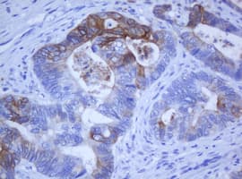 Monoclonal Mouse anti-Human KRT5 / CK5 / Cytokeratin 5 Antibody (clone OTI1F8, IHC)