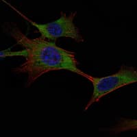 IHC-plus™ HK1 / Hexokinase 1 Antibody (clone 3A10)