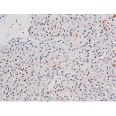 LIMK2 Antibody (phospho-Ser283)