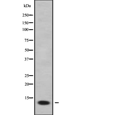 ACBD7 Antibody