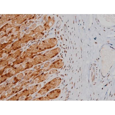 IGF1R / IGF1 Receptor Antibody (phospho-Tyr1346)