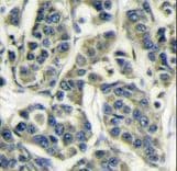 RPS6KB1 / P70S6K / S6K Antibody (aa277-306)