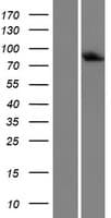 Human LSS Protein (Over-Expression Lysate Myc-DDK (Flag))
