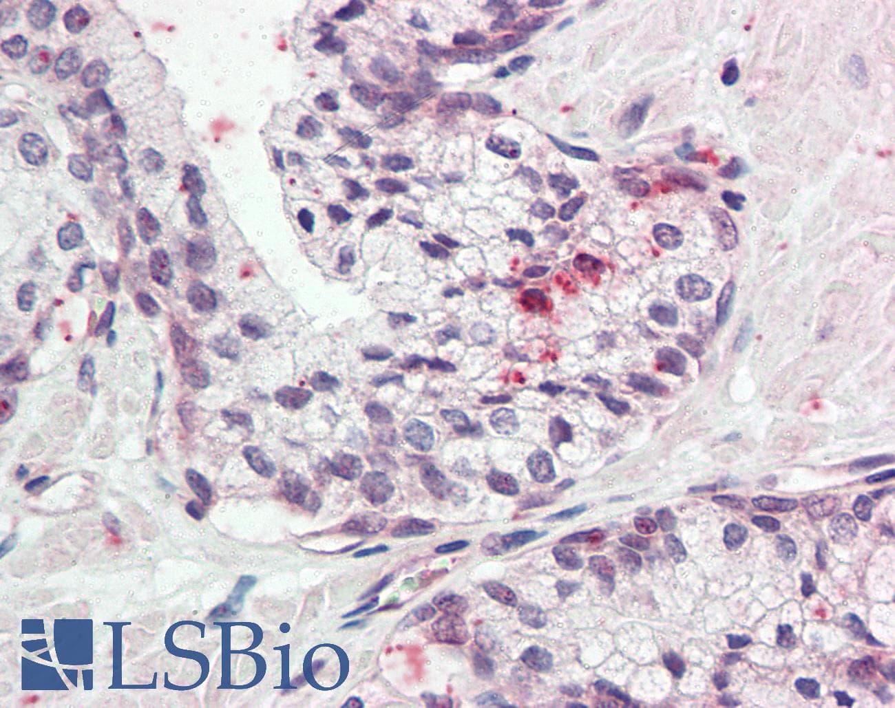 IHC-plus™ KLK11 / Kallikrein 11 Antibody (aa68-82)