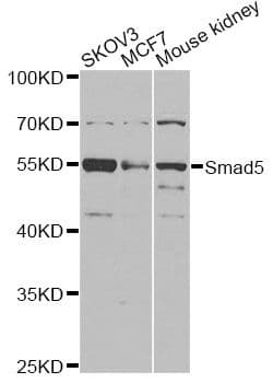 SMAD5 Antibody