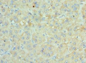 SRPK1 Antibody (aa290-480)