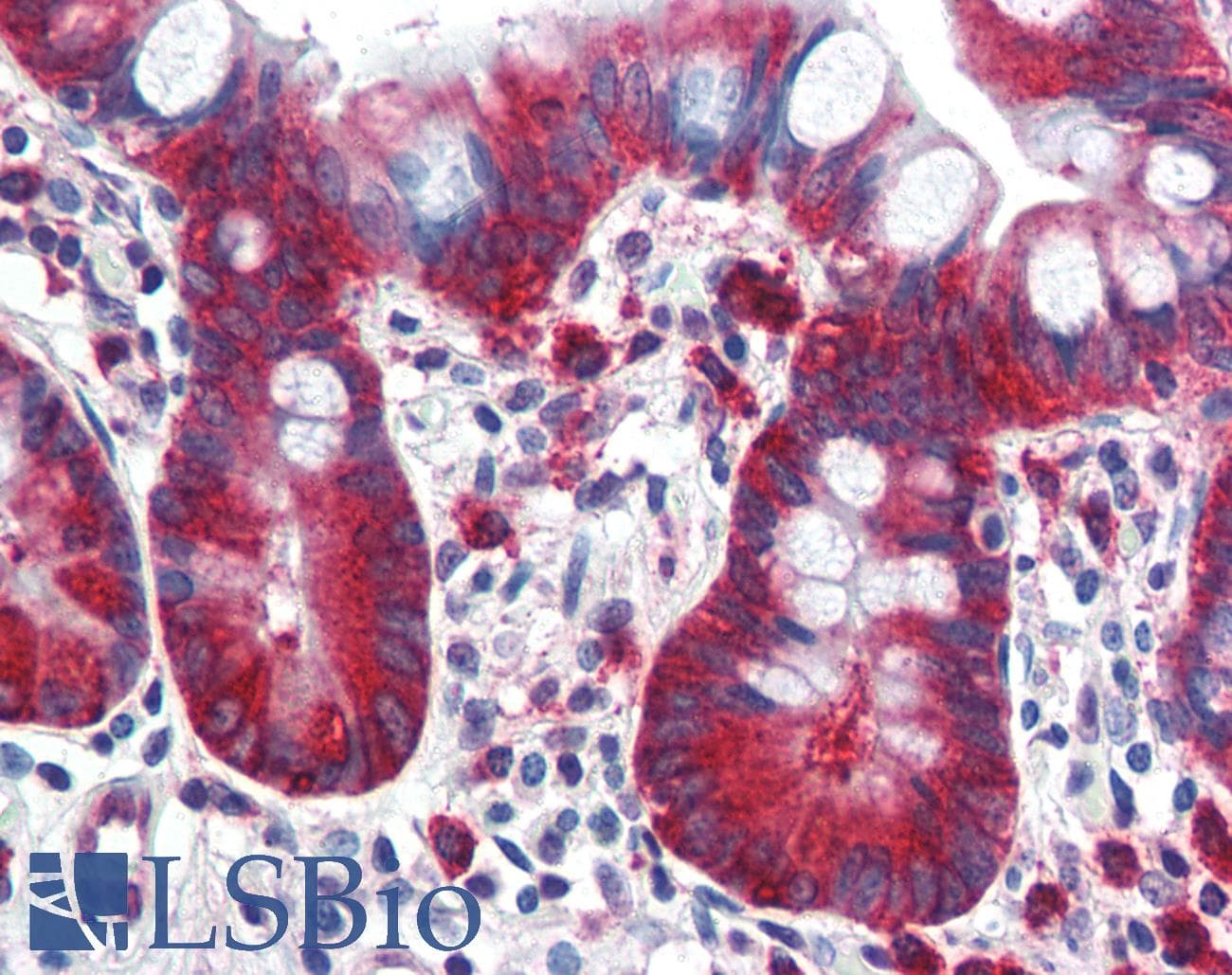 IHC-plus™ Monoclonal Mouse anti-Human TPD52L1 Antibody (clone D1C5, IHC, WB)