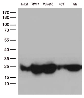 MGMT Antibody (clone OTI17H4)