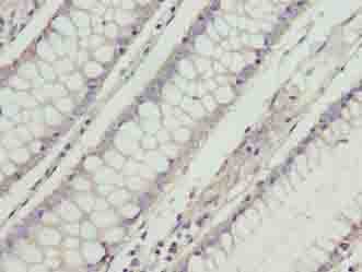 Polyclonal Rabbit anti-Human RD3 Antibody (IHC, WB)