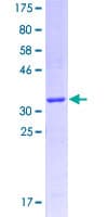 Human GPR119 Protein (Recombinant GST, N-terminus)