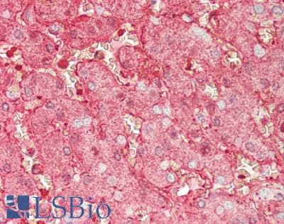 Polyclonal Rabbit anti-Human ALB / Serum Albumin Antibody (IHC, WB)