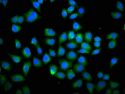 DOCK180 / DOCK1 Antibody