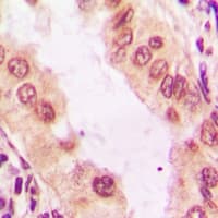 SMEK1 Antibody