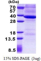 Human RNASEH2A Protein (Recombinant His)