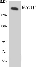 Polyclonal Rabbit anti-Human MYH14 Antibody (aa1034-1083, WB)