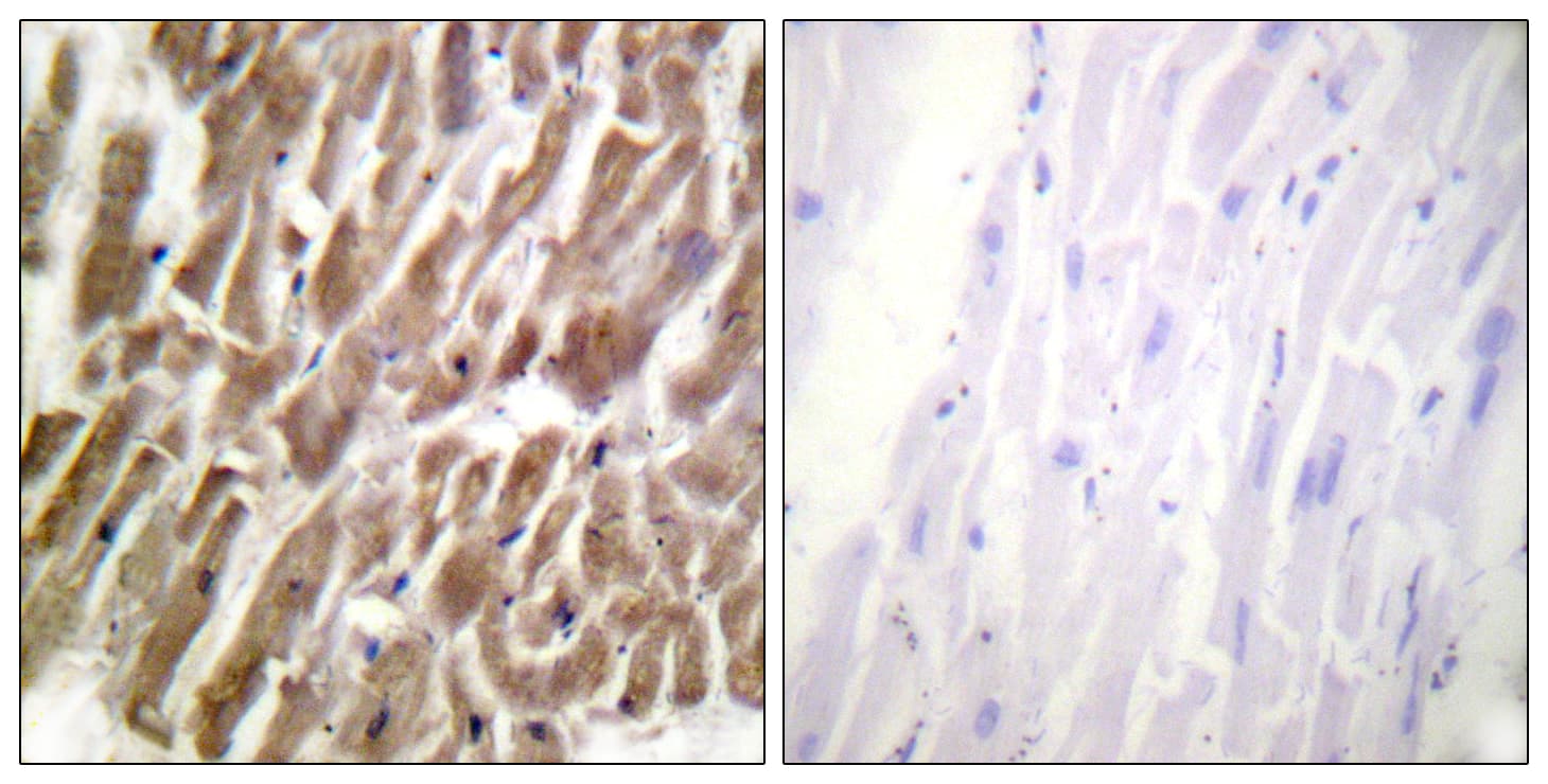 TNNI3 / Cardiac Troponin I Antibody (aa11-60)