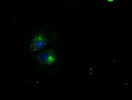 Monoclonal Mouse anti-Human CD4 Antibody (clone OTI4A11, IF, WB)