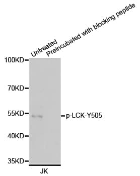 p56lck / LCK Antibody (phospho-Tyr505)