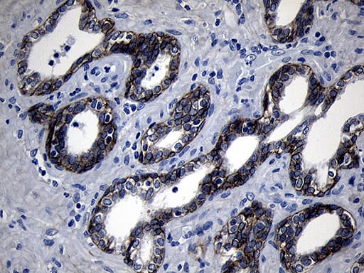 Monoclonal Mouse anti-Human ROR2 Antibody (clone OTI4B10, aa796-927, IHC, WB)