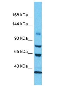 KIAA0528 Antibody (aa237-286)