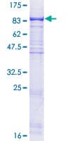 Human WDR59 Protein (Recombinant GST)