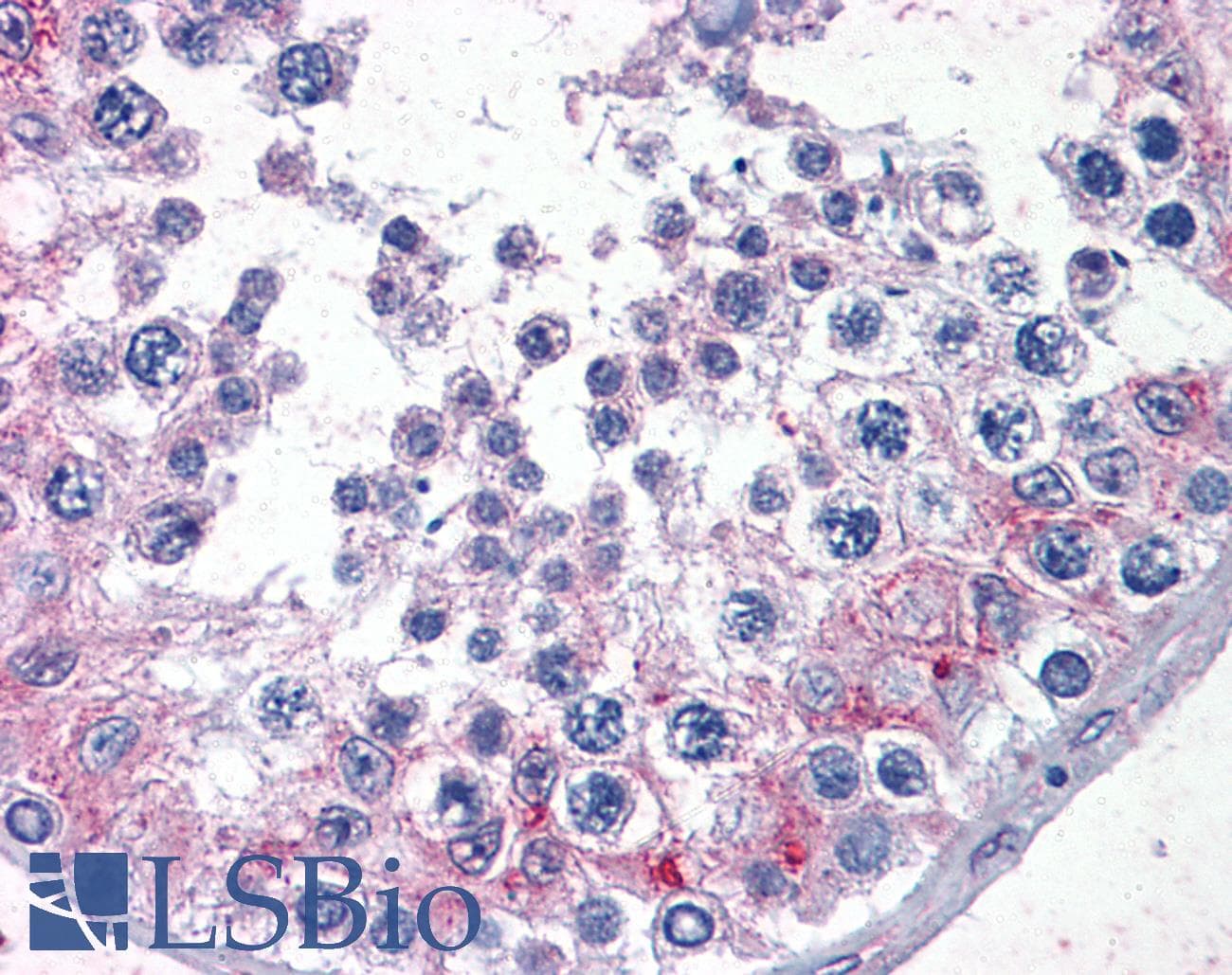 IHC-plus™ Monoclonal Mouse anti-Human CDKL2 Antibody (clone 1F6, IHC, WB)