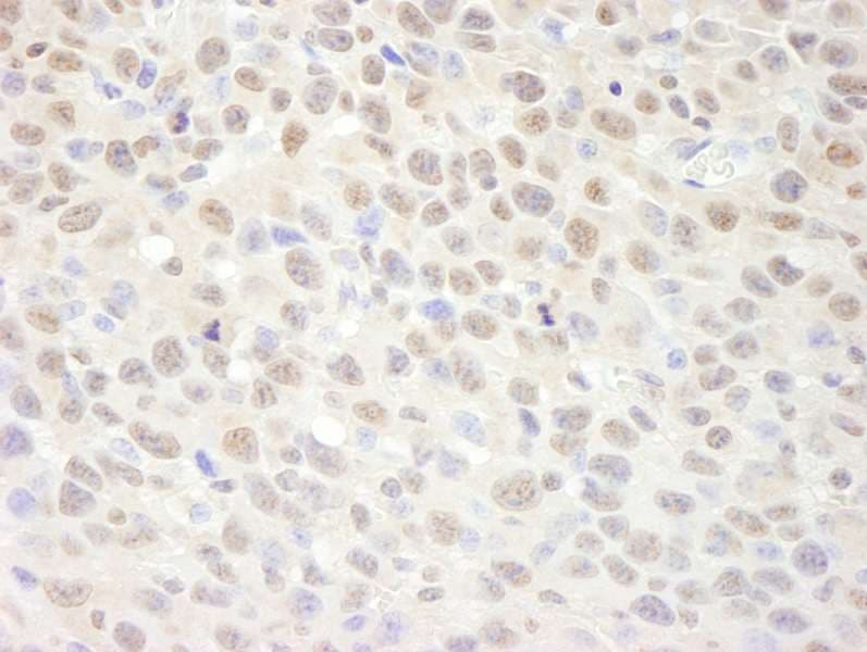 SUPT6H / SPT6 Antibody (aa425-475)