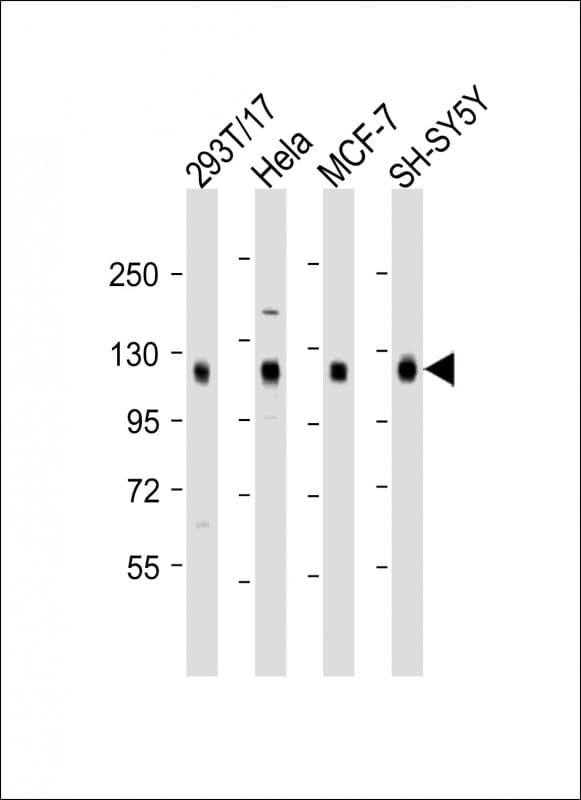 Polyclonal Rabbit anti-Human DLG1 / SAP97 Antibody (aa643-673, WB)