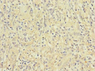 Polyclonal Rabbit anti-Human ITGAX / CD11c Antibody (IHC, IF, WB)