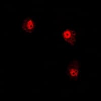 RD / PHYH Antibody